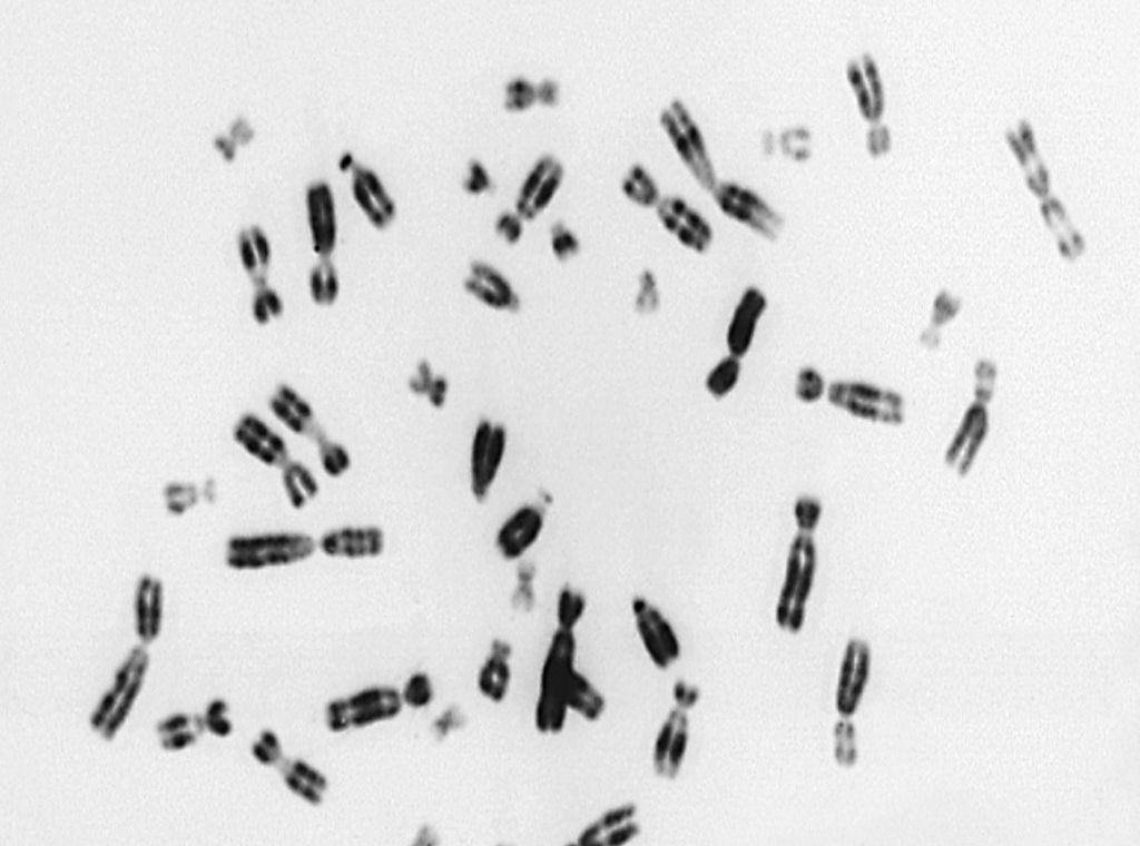 Charité-Studie- Wie Zellen mit zu vielen Chromosomen umgehen
