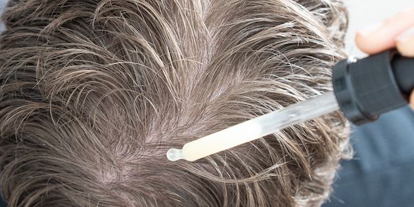 Myrto Naturkosmetik – Haarausfall: vorbeugen und behandeln